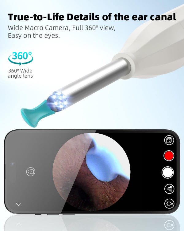 Ear Wax Removal with Camera and Light - AILE Ear Cleaner - Ear Wax Removal Tool - 1080P Otoscope - Ear Cleaning Kit for iPhone, iPad, Android Phones (White) - Image 3