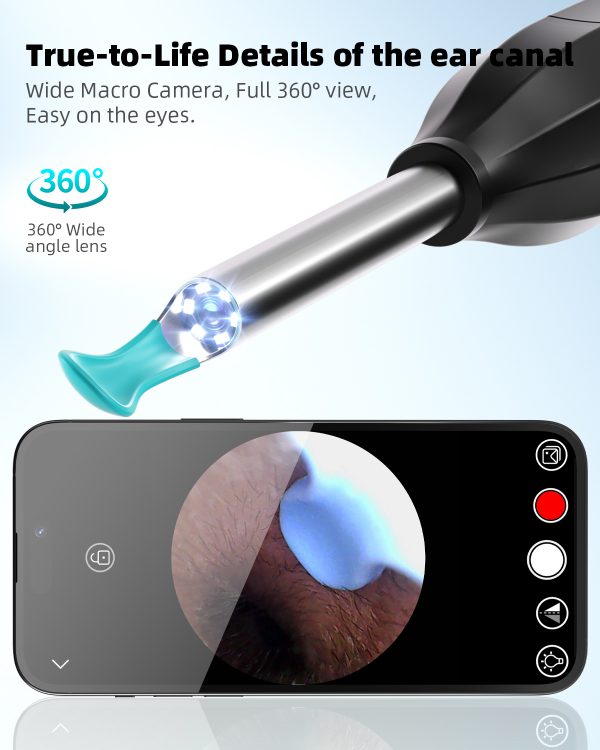 Ear Wax Removal with Camera and Light - AILE Ear Cleaner - Ear Wax Removal Tool - 1080P Otoscope - Ear Cleaning Kit for iPhone, iPad, Android Phones (Black) - Image 3